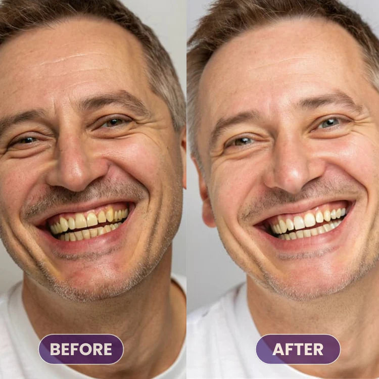 PureVerge© Purple Whitening Toothpaste