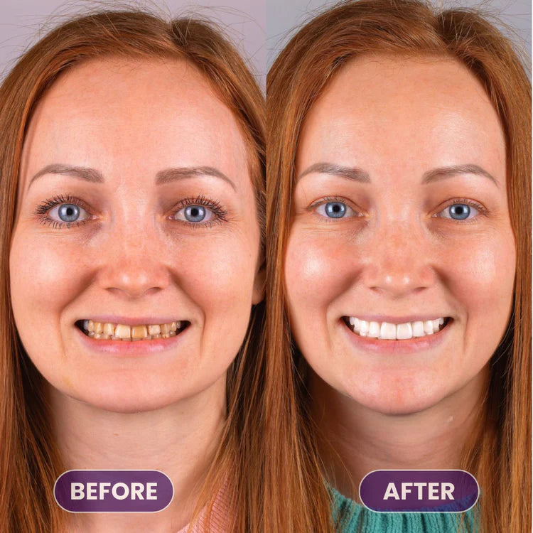 PureVerge© Purple Whitening Toothpaste