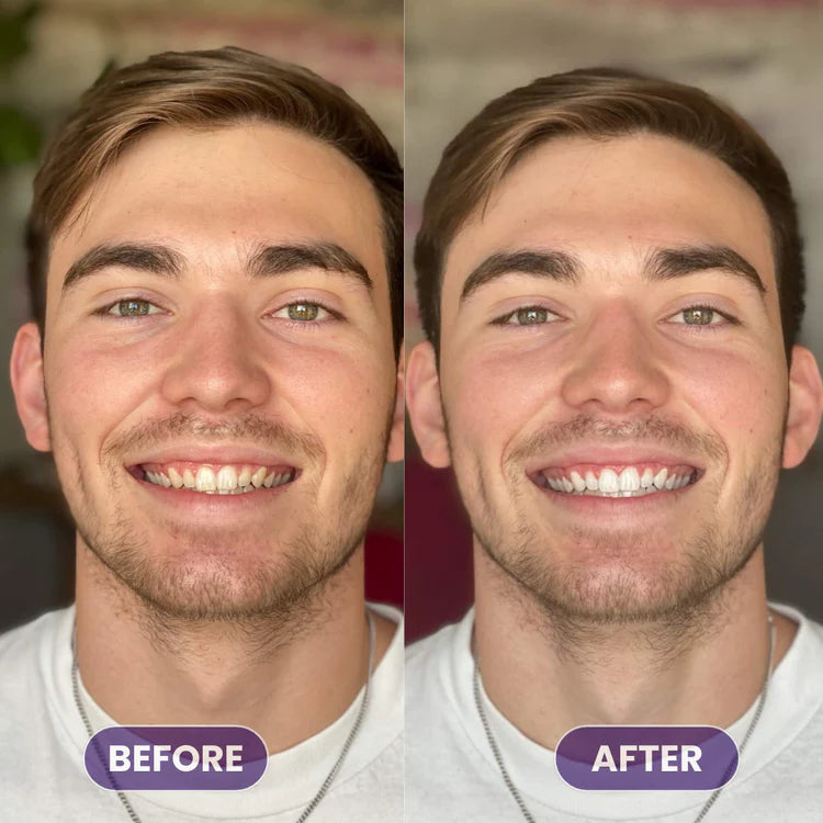 PureVerge© Purple Whitening Toothpaste