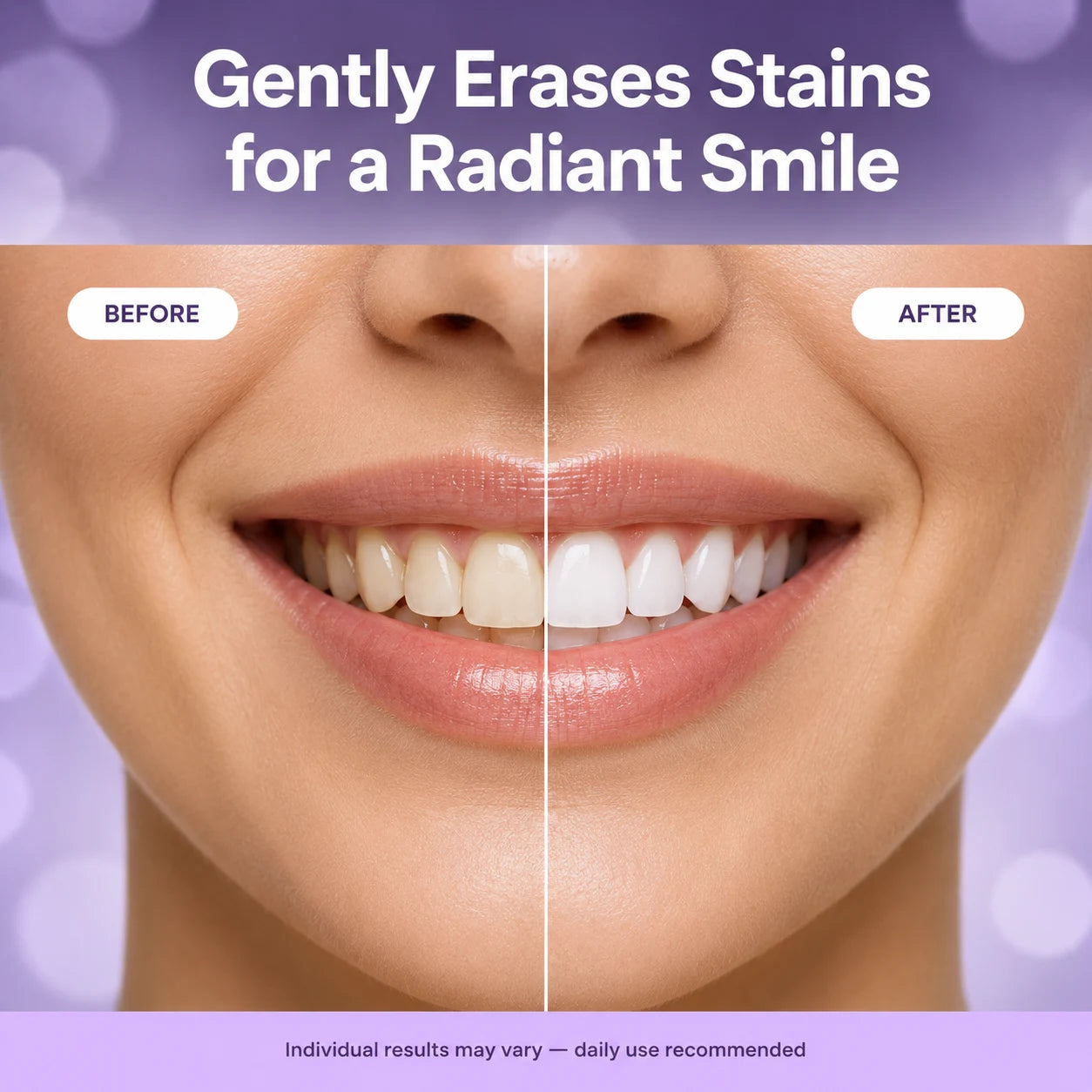 PureVerge® 7 Pro Purple Whitening Toothpaste