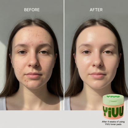 Pads Uniformadores e Iluminadores